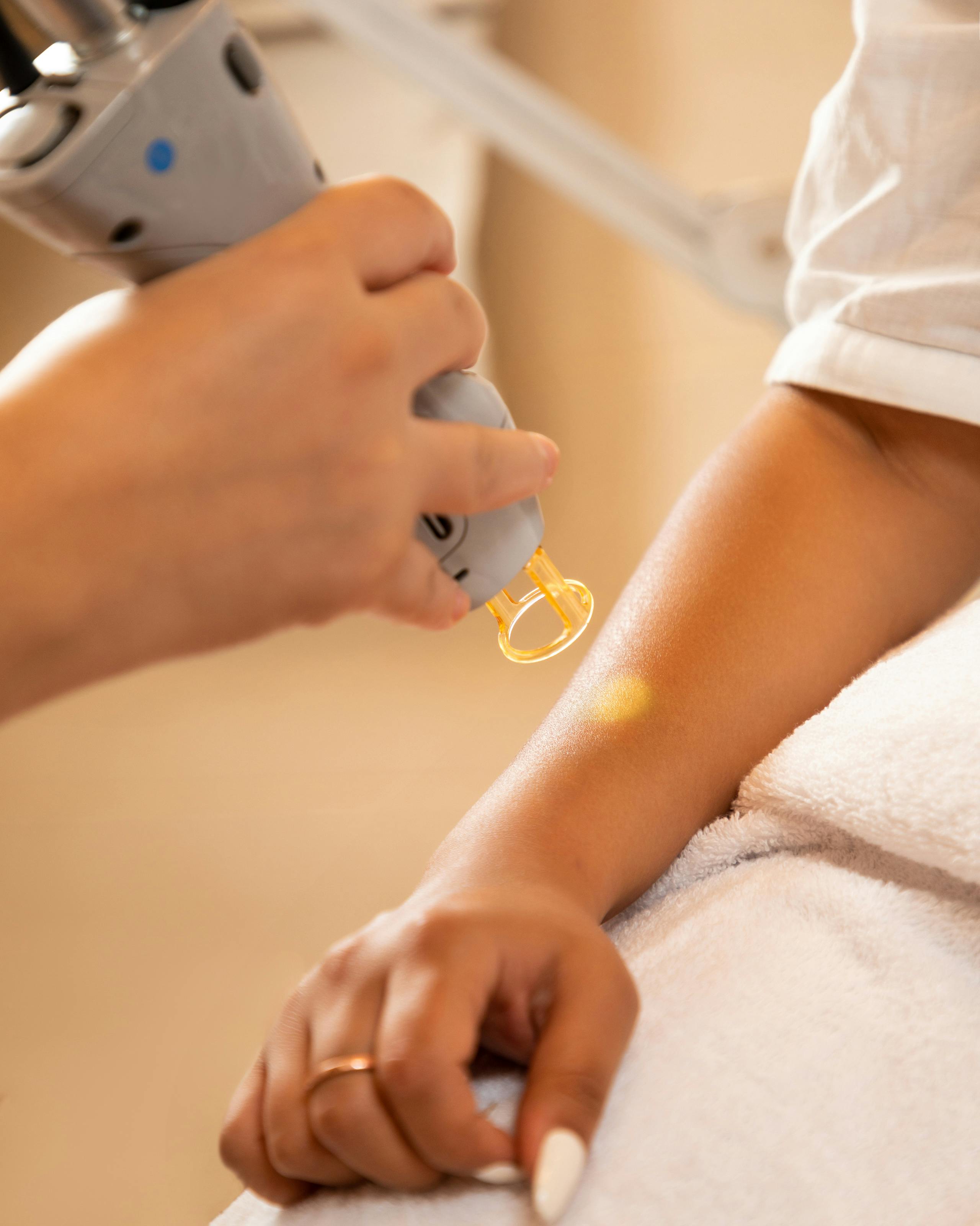 Why Laser Hair Removal is Becoming the Go-To Choice for Brides-to-Be