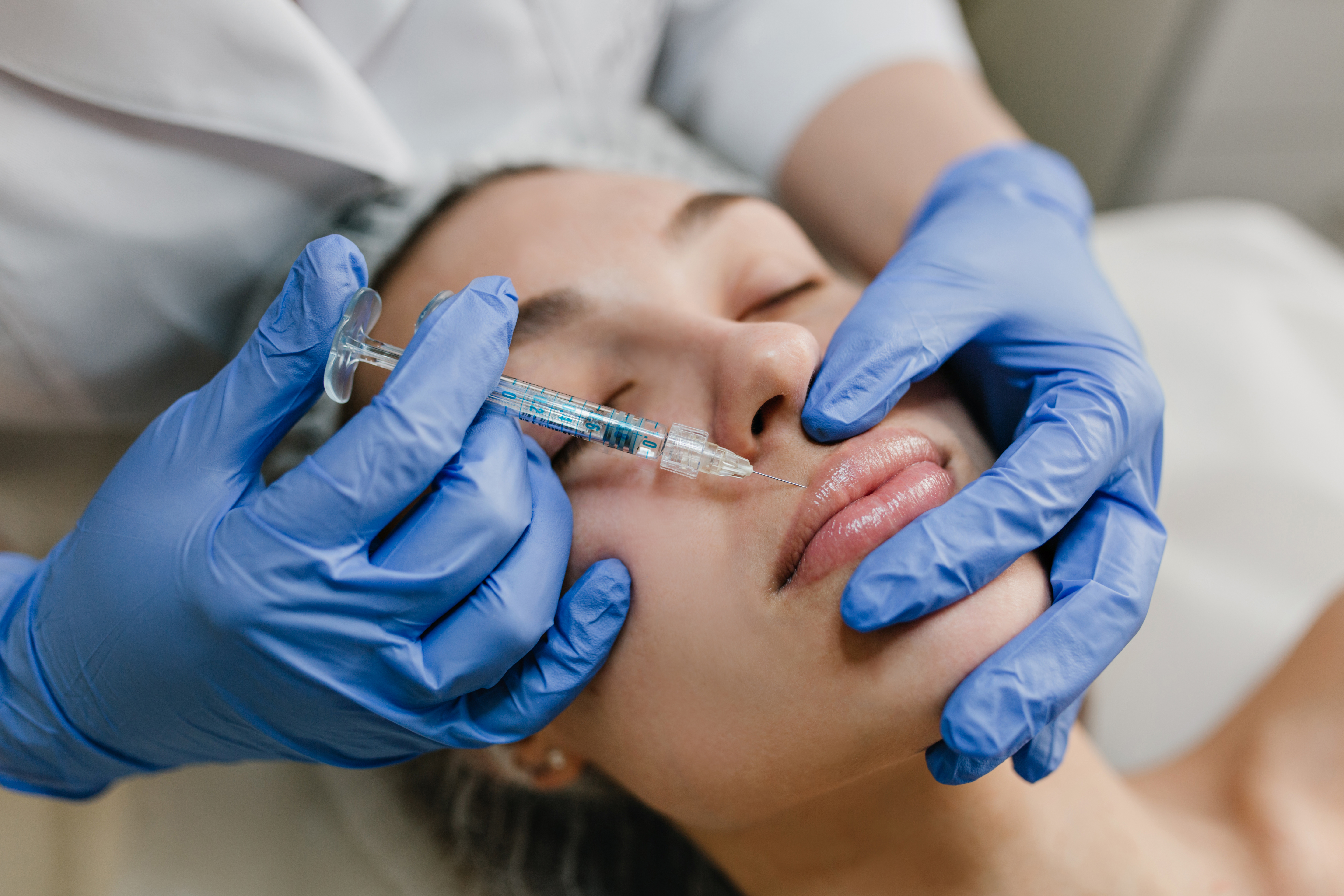 Get the Best Lip Pigmentation Treatment in Andheri: Causes, Solutions & Expert Care by Dr. Samreen Khan