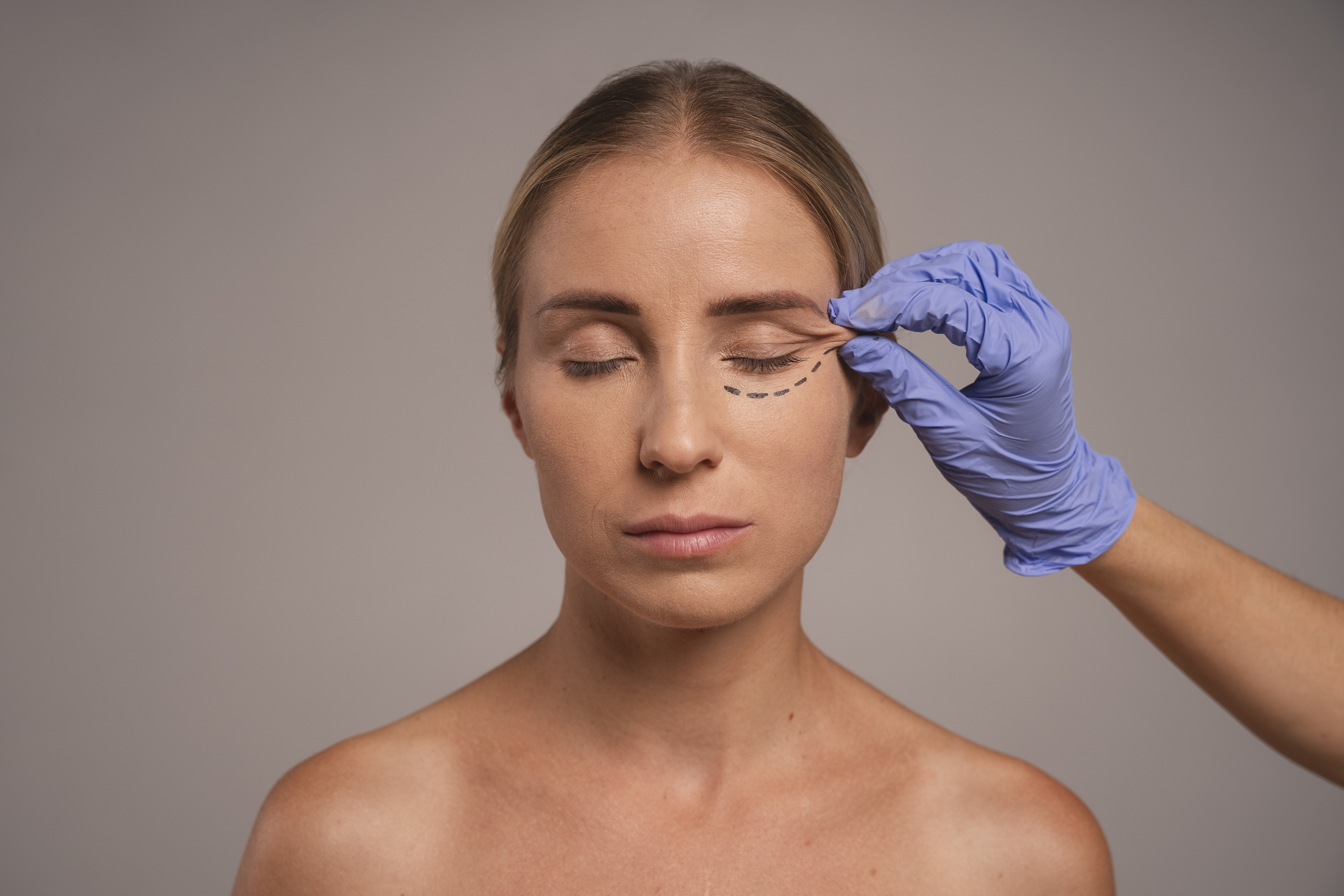Turn Back Time: Enhance Your Smile with Advanced Thread Lift by Dr. Samreen Khan in Andheri