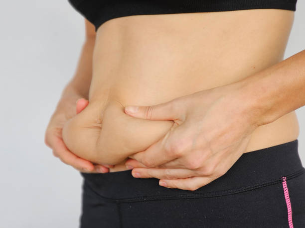 Best Non-Surgical Solutions for Belly Fat Reduction