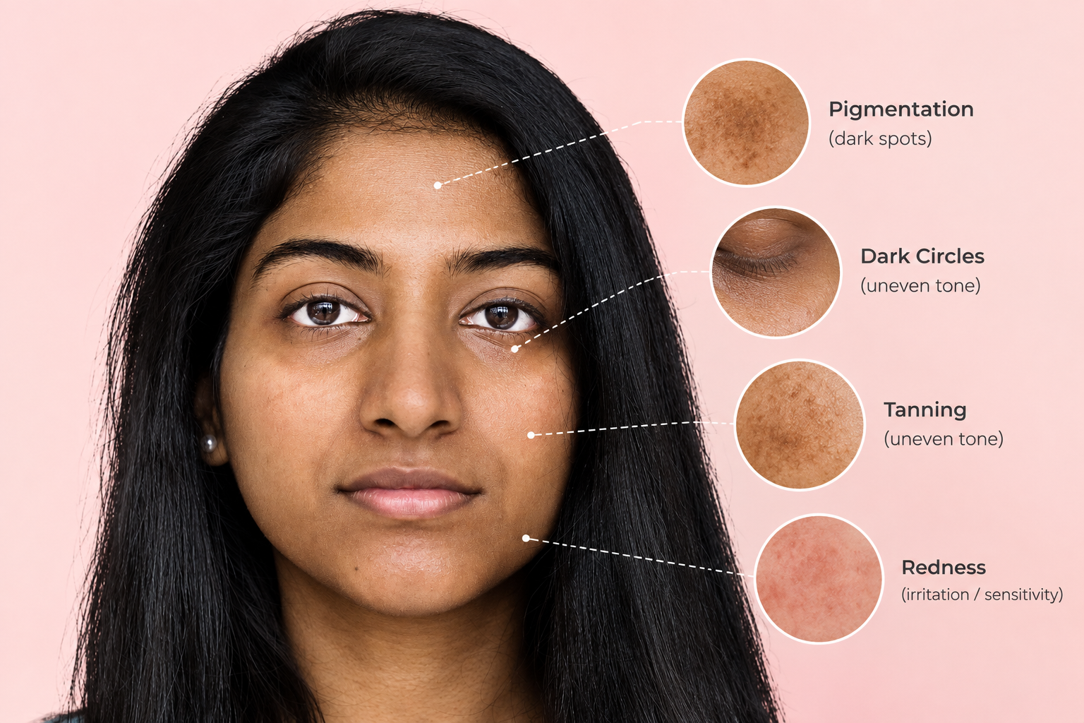 How to Get Rid of Uneven Skin Tone and Achieve Brighter Skin